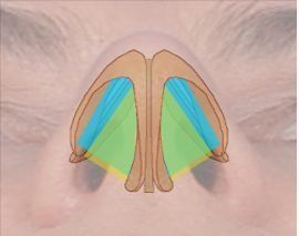 nasal valve base view graphic