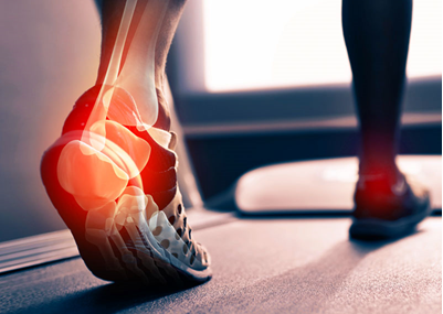 Achilles Tendonitis Pain Visual — Diamond, IL — Diamond Therapy Center Achilles Tendonitis Pain Visual — Diamond, IL — Diamond Therapy Center