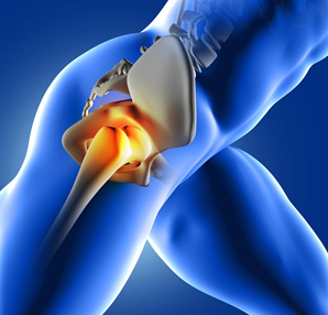 Hip Pain Visual — Diamond, IL — Diamond Therapy Center Hip Pain Visual — Diamond, IL — Diamond Therapy Center