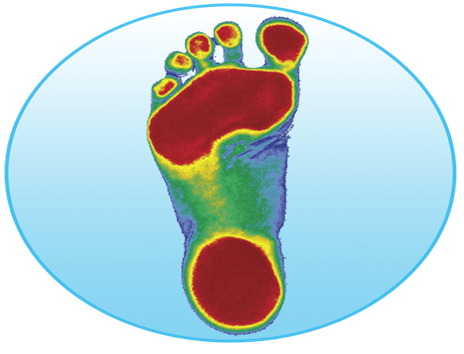 Overpronation Image One X-RAY — Diamond, IL — Diamond Therapy Center Overpronation Image One X-RAY — Diamond, IL — Diamond Therapy Center