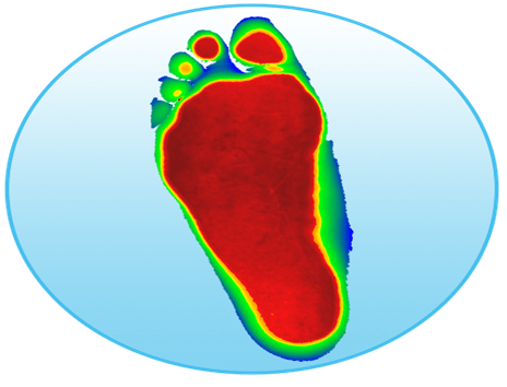 Overpronation Image Two X-RAY — Diamond, IL — Diamond Therapy Center Overpronation Image Two X-RAY — Diamond, IL — Diamond Therapy Center