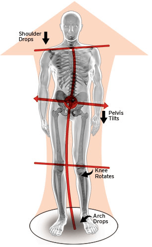 Lower Back Pain Visual — Diamond, IL — Diamond Therapy Center Lower Back Pain Visual — Diamond, IL — Diamond Therapy Center