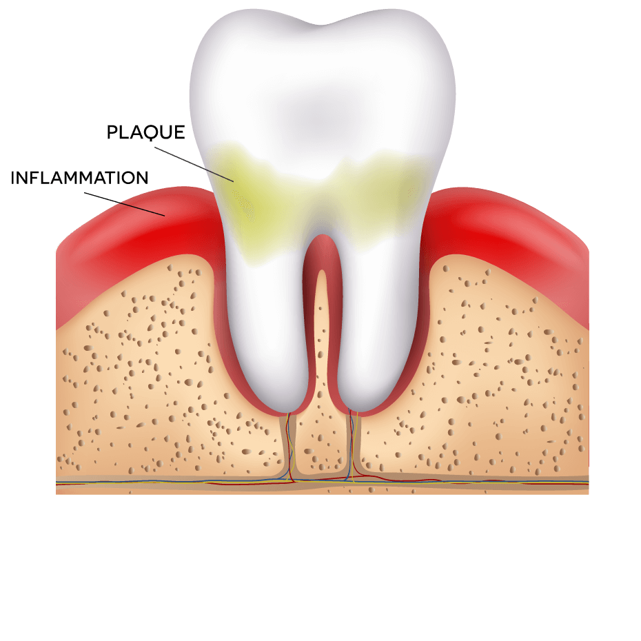 Restoring Health - Periodontists in Red Deer County