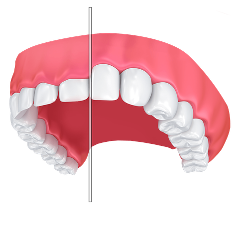 Enhancing Appearnace - Periodontists in Red Deer County