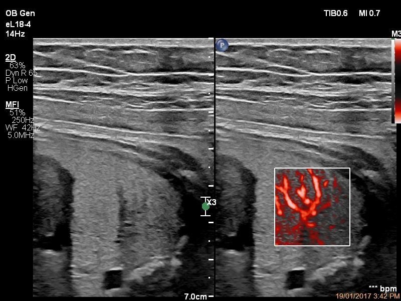 ultrasound machine
