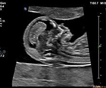 pregnant and finger