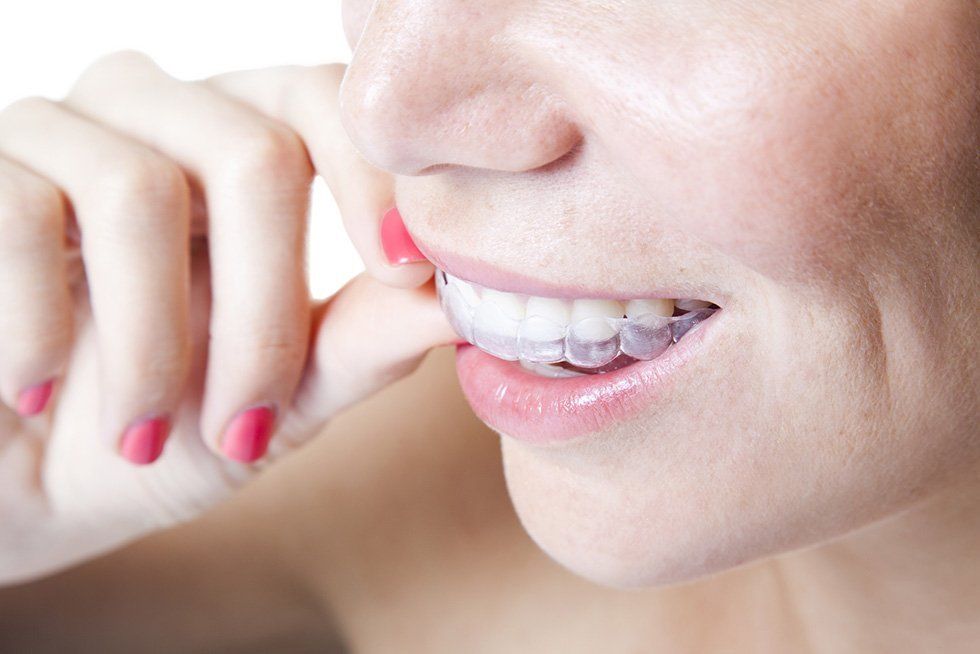 controllo dei denti