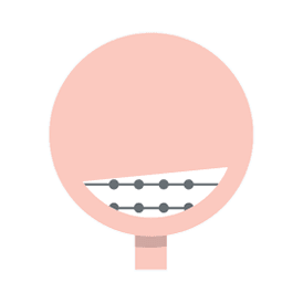 Ortodonzia