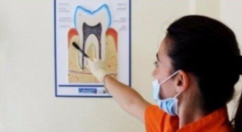 cura dei denti