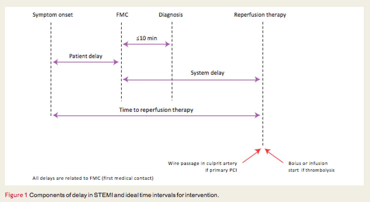 Delays in STEMI with ideal times for intervention