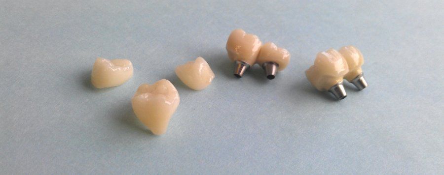 Smiling couple with beautiful teeth