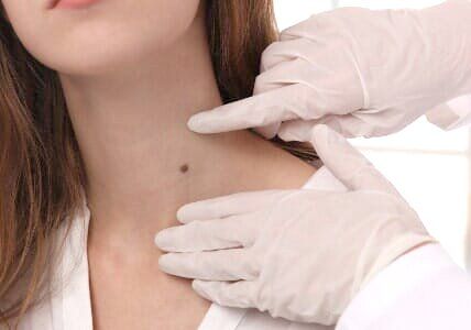 Dermatology — Doctor Examines Mole of a Woman in Bethpage, NY Dermatology — Doctor Examines Mole of a Woman in Bethpage, NY