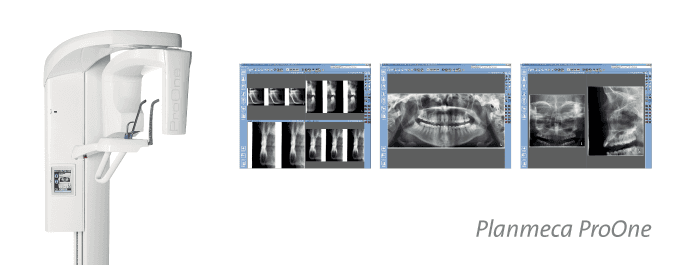 Ortopantomografia Ortopantomografia