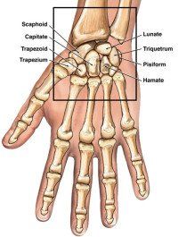 Kleiser Therapy Treats Scaphoid Fractures