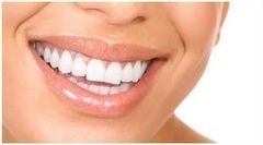 sbiancamento denti sbiancamento denti