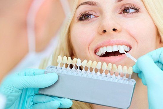Woman having teeth color matched by dentist using a shade guide.