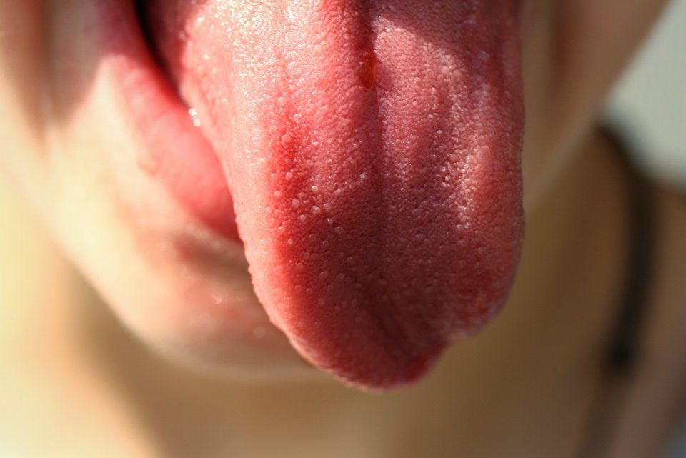 Do you need to go to the doctor? Stick out your tongue. The color and appearance of this muscle can tell you a lot about your health.