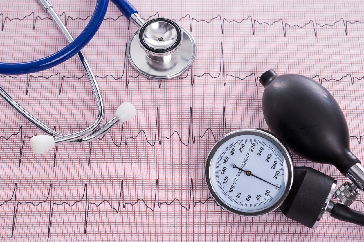 A blue stethoscope and a black blood pressure monitor gauge resting on a medical ECG heart rhythm strip.