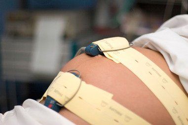 CARDIOTOGRAFIA