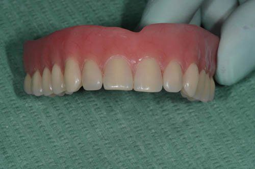 dentiera