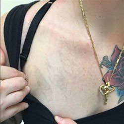 A woman has a tattoo of a rose on her chest