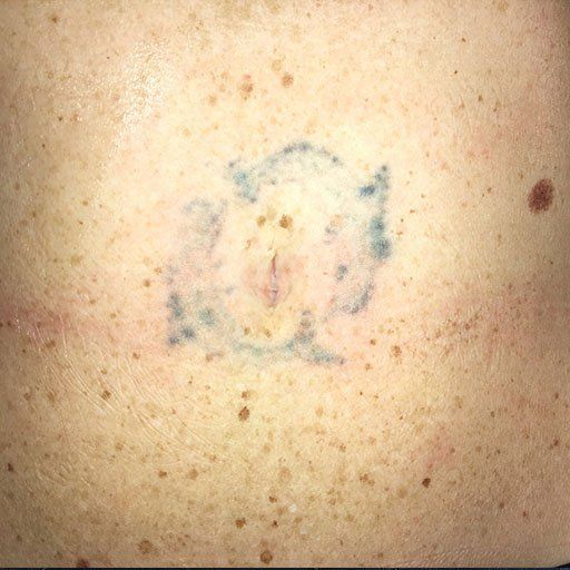 A close up of a person 's back with a tattoo on it.