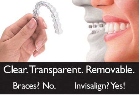 invisalign