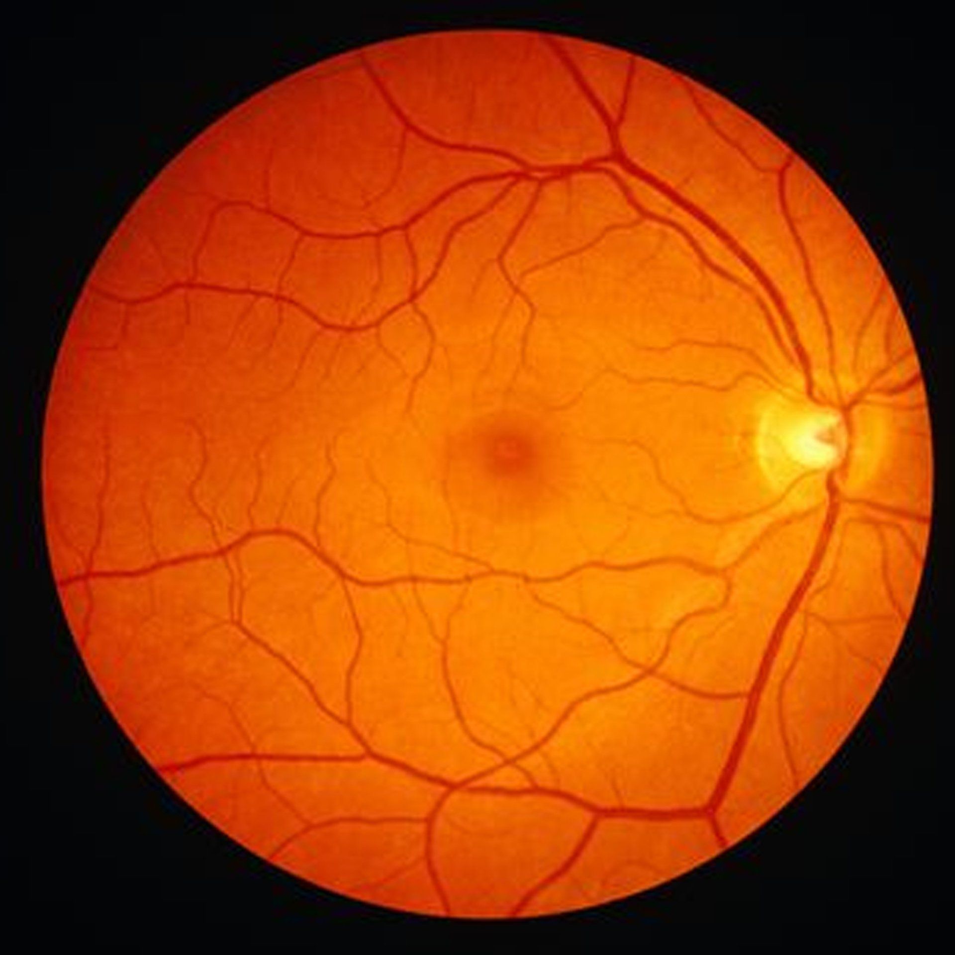 A close up of a person 's eye with a black background.
