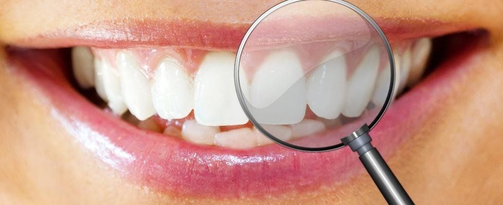 cura dei denti