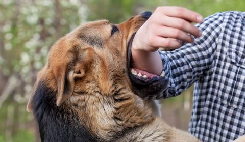 Dog Bites — Dog Bites The Arm Of The Man in Visalia, CA