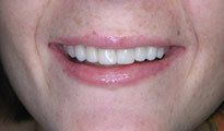 Orthodontic Gallery 2