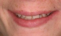 Orthodontic Gallery 1