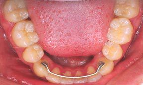 Orthodontic Gallery 4