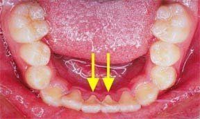 Orthodontic Gallery 3