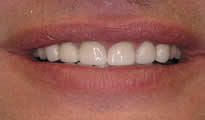 Periodontal Gallery 2