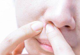 Woman With Acne Scars — Dermatology in Howard Beach NY Woman With Acne Scars — Dermatology in Howard Beach NY