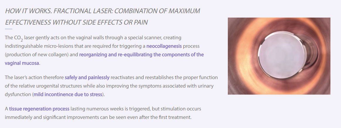 Premenstrual Syndrome — How It Works. Fractional Laser in Lima, OH Premenstrual Syndrome — How It Works. Fractional Laser in Lima, OH