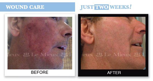 Renaissance Therapeutic Massage INC