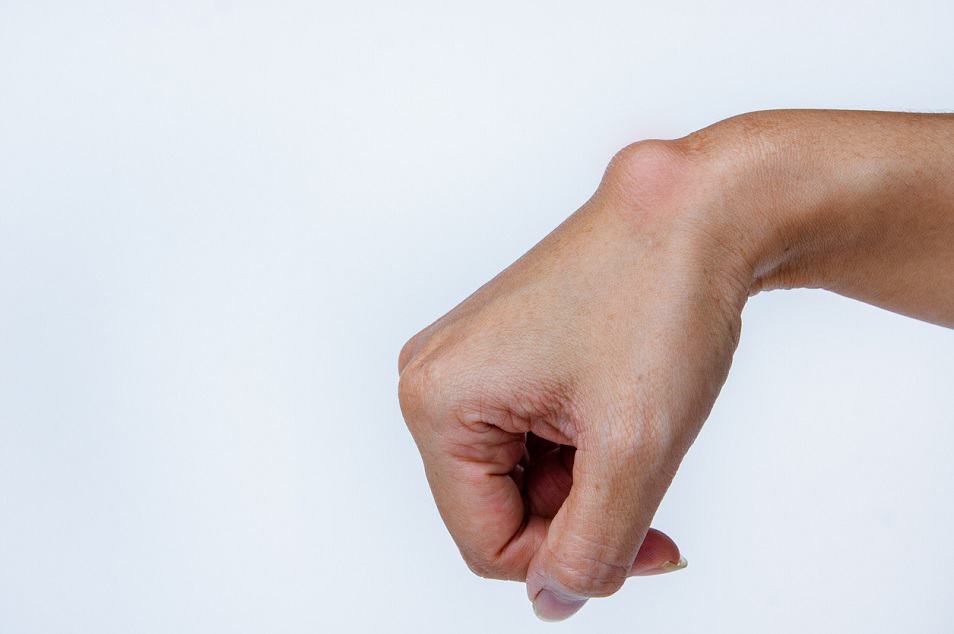 cetema fisioterapia