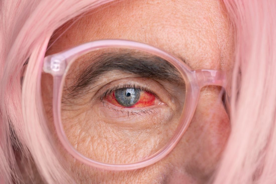 prevenzione glaucoma
