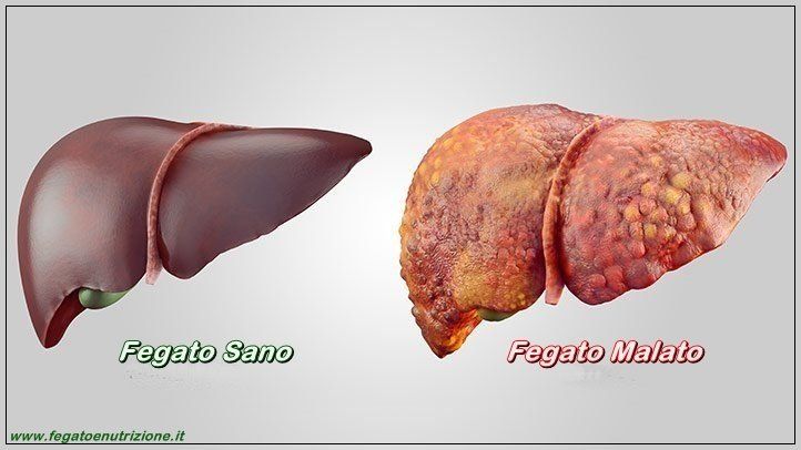 fegato e nutrizione correlazione tra stile di vita e fegato sano