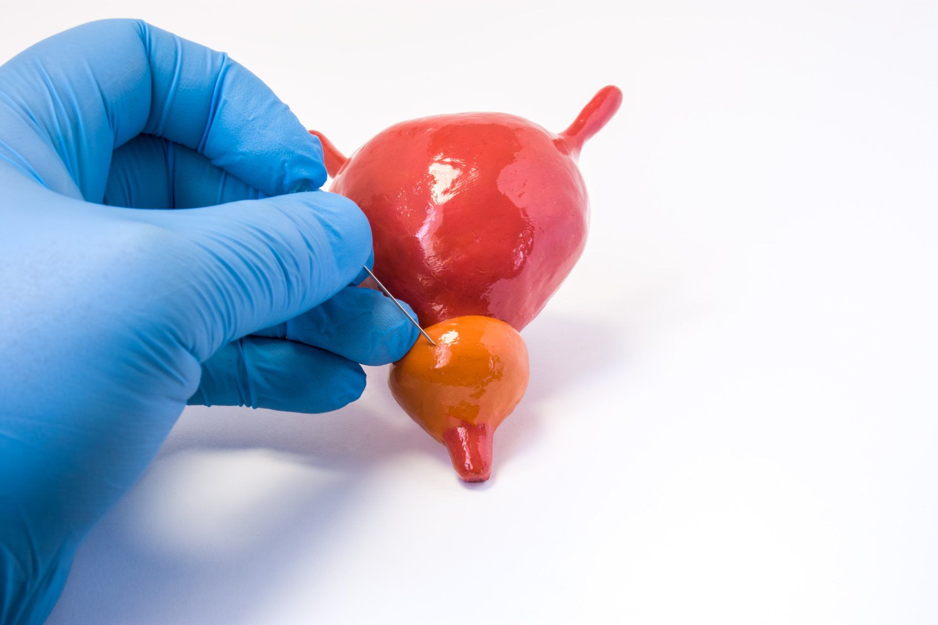 Prostate problems
