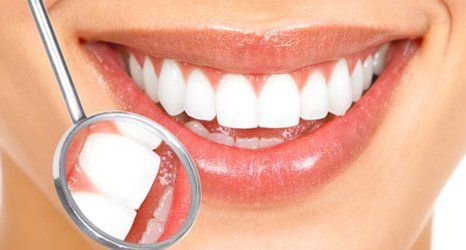 Tooth coloured fillings