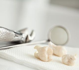 Extractions — Extractions in Washington, DC Extractions — Extractions in Washington, DC