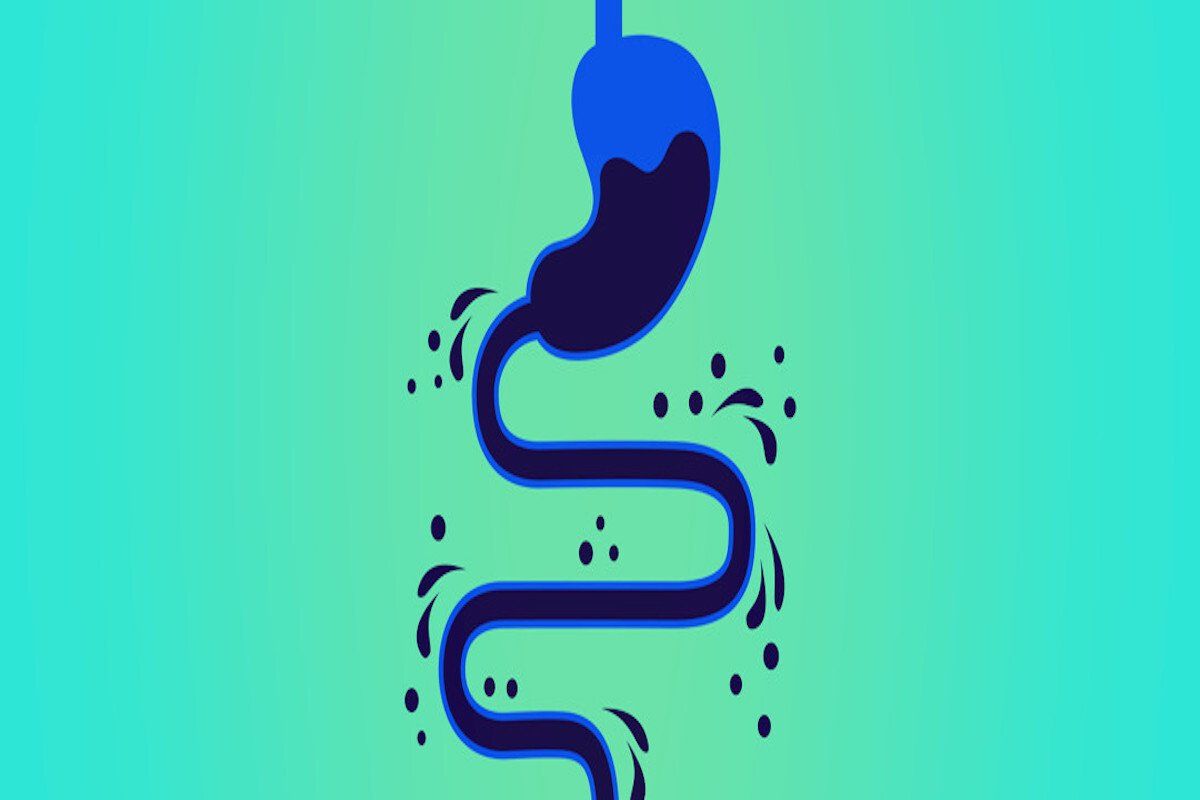 Could Leaky Gut Be Causing Your Immune Symptoms?