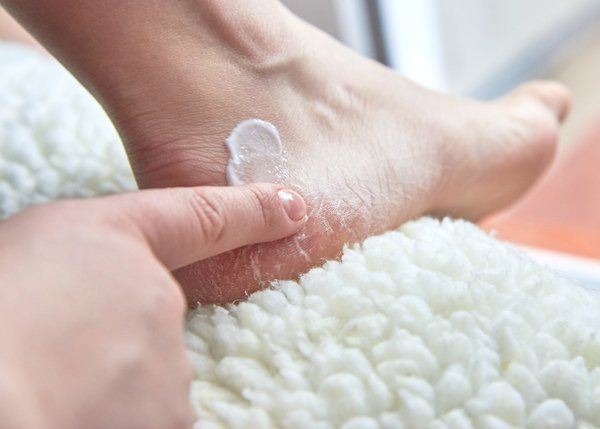 Skin Conditions — Cream Dry Feet Covered with Cracks in Lake Zurich, IL Skin Conditions — Cream Dry Feet Covered with Cracks in Lake Zurich, IL