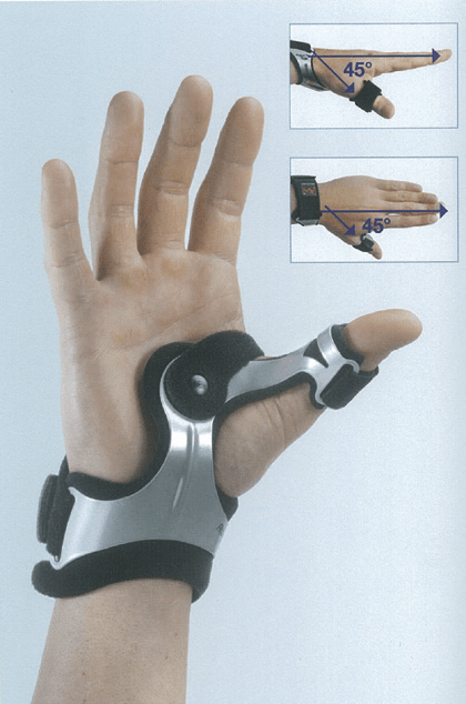 Protesi per la mano