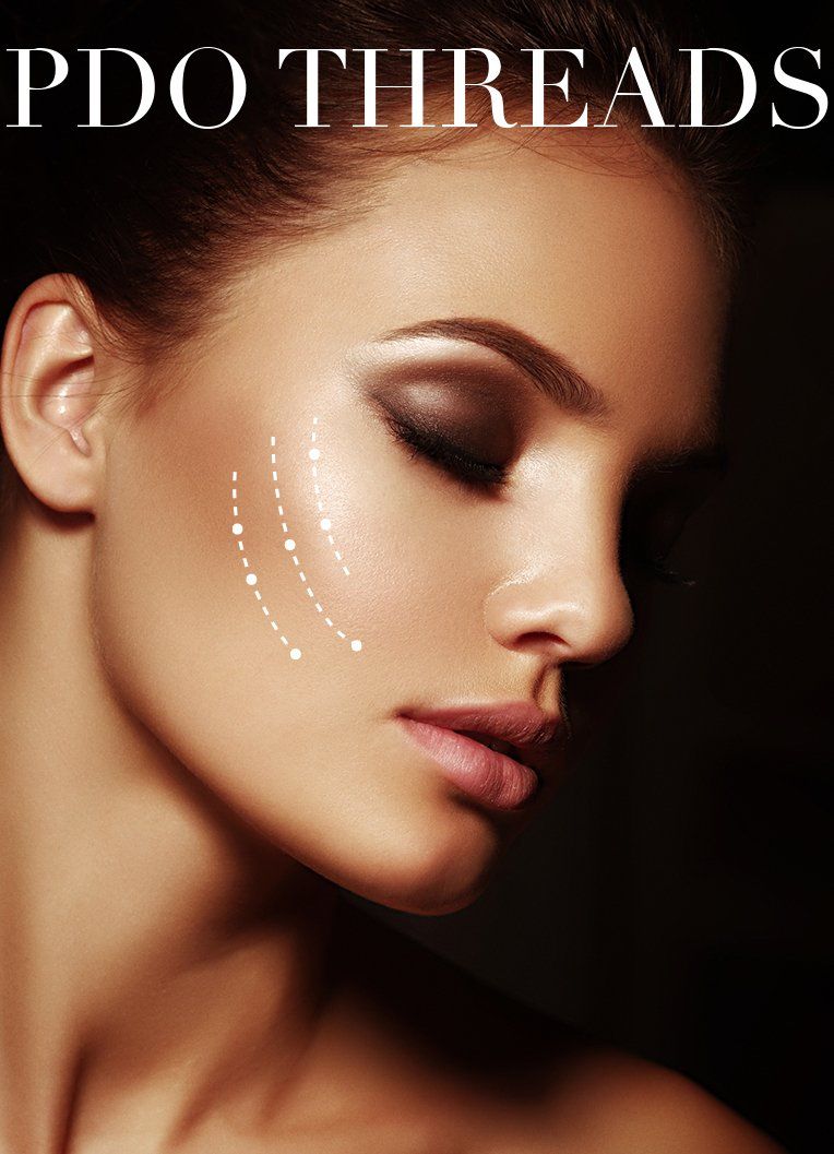 PDO thread lift treatment at Skin & Soul Med Spa in Seabrook TX