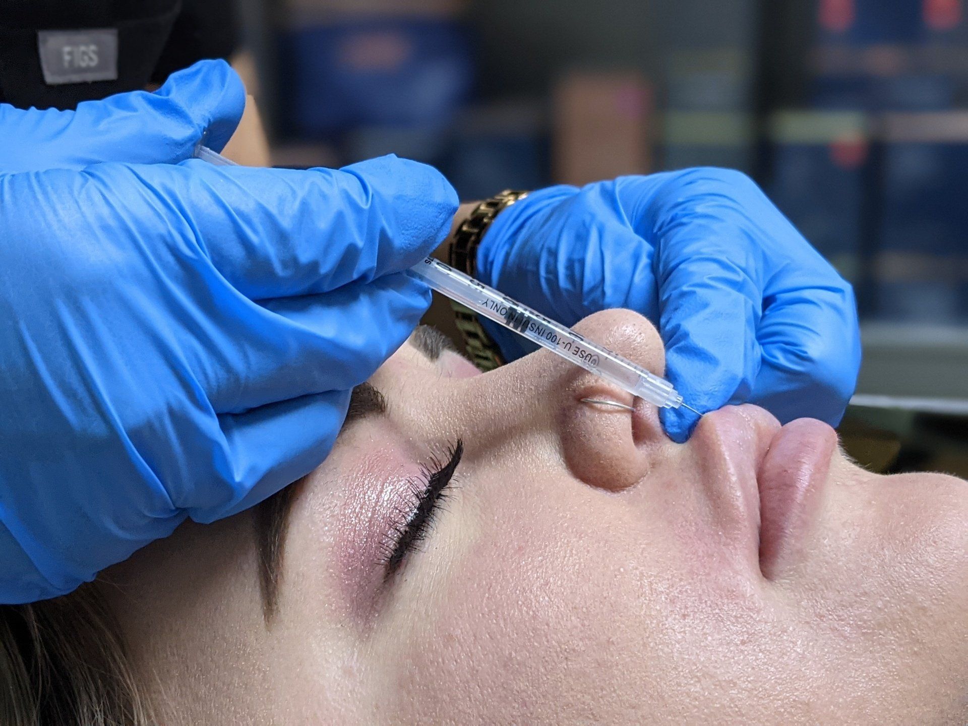 Lip filler treatment at Skin & Soul Med Spa Seabrook TX