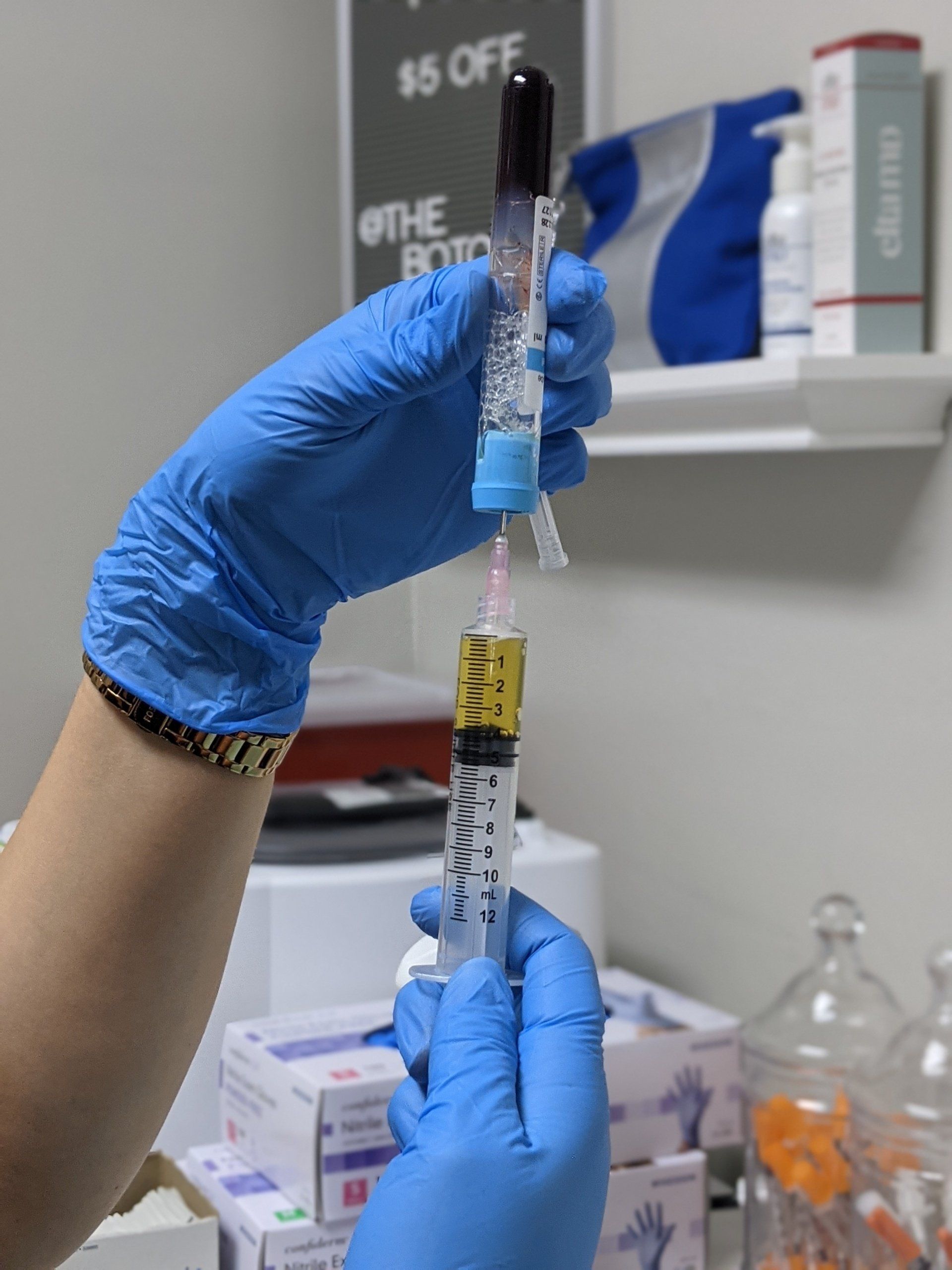 PRP scalp injection vial for hair restoration at Skin & Soul Med Spa near Clear Lake TX